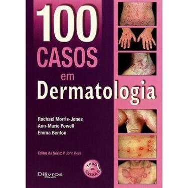 Imagem de 100 Casos Em Dermatologia - Di Livros -
