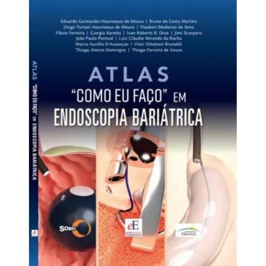 Imagem de Atlas "como Eu Faço" Em Endoscopia Bariátrica