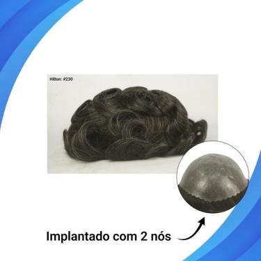 Imagem de Protese Capilar Micropele Hilton Tamanho 20X25 D=130%