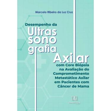 Imagem de Desempenho da Ultrassonografia Axilar com Core Biópsia na Avaliação do Comprometimento Metastático A