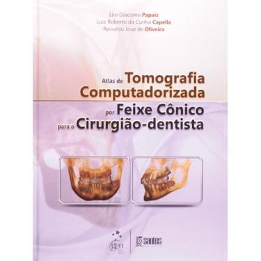 Imagem de Livro - Atlas de Tomografia Computadorizada por Feixe Cônico para o Ci