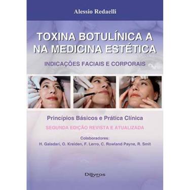 Imagem de Toxina Botulinica E Na Medicina Estetica