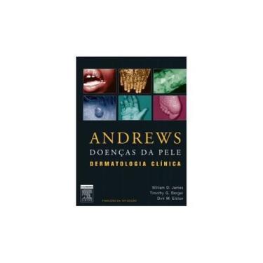 Imagem de Andrews Doenças da Pele - ELSEVIER BRASIL (PROF)
