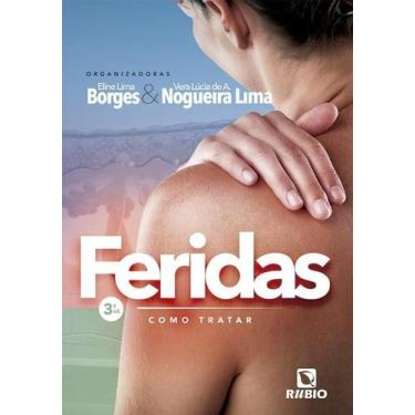 Imagem de Feridas: Como Tratar, Autor: Borges, Eline Lima / Lima, Vera Lúcia De 