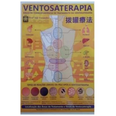 Imagem de Genérico Mapa Terapeutico de Ventosaterapia A4