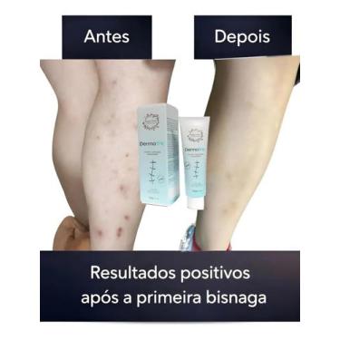 Imagem de Creme Pomada De Cicatriz 20g Tg - tiarga & Inoue Cosméticos