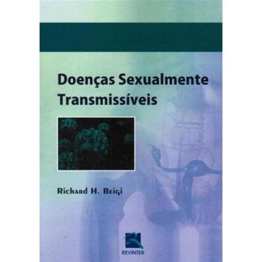 Imagem de Doencas Sexualmente Transmissiveis