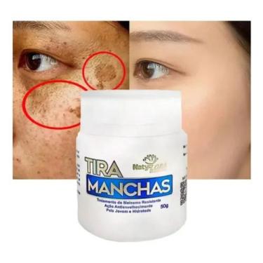 Imagem de Creme Facial Clareador Melasma Acne Sardas Manchas Escuras Naty Flora 