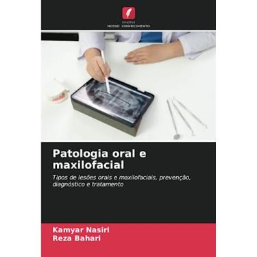 Imagem de Patologia oral e maxilofacial: Tipos de lesões orais e maxilofaciais, prevenção, diagnóstico e tratamento