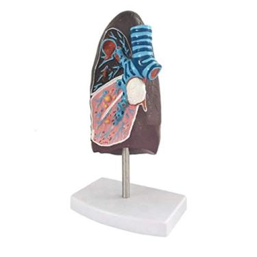 Imagem de P9IDEDFH Modelo de anatomia pulmão órgão médico humano patológico anatomico sistema respiratório modelo para medicina biologia laboratório demonstração de ensino de ciências requintado