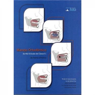 Imagem de Manejo ortodontico da ma oclusao de classe ii - LIV TOTA, 3
