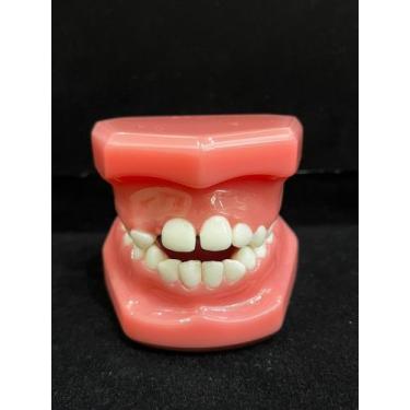 Imagem de RD-042 Modelo Pediatria Dentição Mista Classe I Mordida Aberta - ROIC