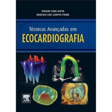 Imagem de Técnicas Avançadas Em Ecocardiografia