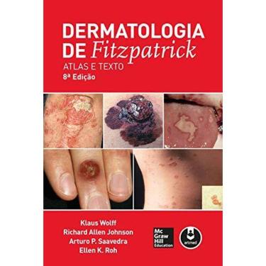 Imagem de Dermatologia de Fitzpatrick - Atlas e Texto