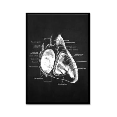 Imagem de Fundo preto anatomia humana arte médica impressões em tela imagens músculo esqueleto vintage pôster educação pintura arte decoração de parede (SKU13,20.3x30.5 cm = (20x30cm), moldura de metal preto)