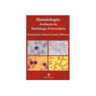 Imagem de Hematologia: Avaliação Da Morfologia Eritrocitária (Pranchas) - Editor