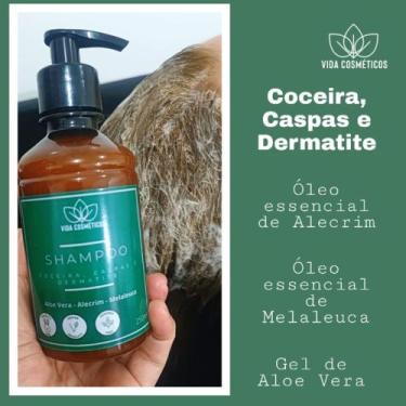 Imagem de Shampoo Tratamento Caspas Dermatite Coceira Vegano 250ml - Vida Cosmét