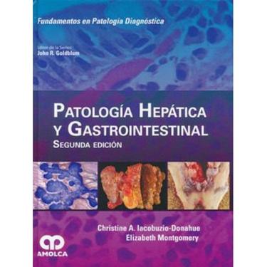 Imagem de Patologia Hepatica Y Gastrointestinal