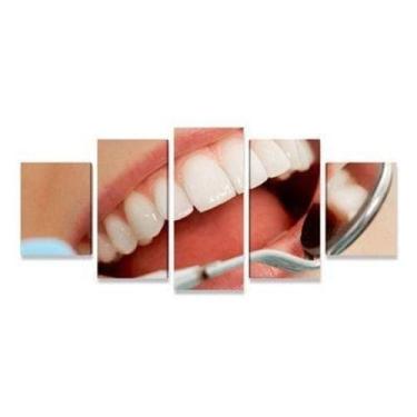 Imagem de Quadro Decorativo Dentista Sorriso Dentes Branco Kit 5 peças Decoração