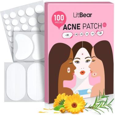 Imagem de Adesivos para acne e espinhas LitBear Large 100 adesivos com óleo de m