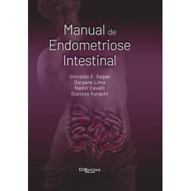 Imagem de Manual De Endometriose Intestinal - -
