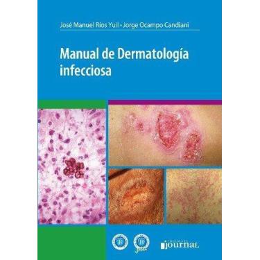 Imagem de Manual De Dermatologia Infecciosa (Espanhol) - Ediciones Journal Sa