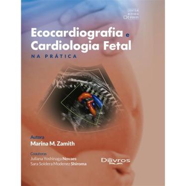 Imagem de Ecocardiografia E Cardiologia Fetal E Pratica