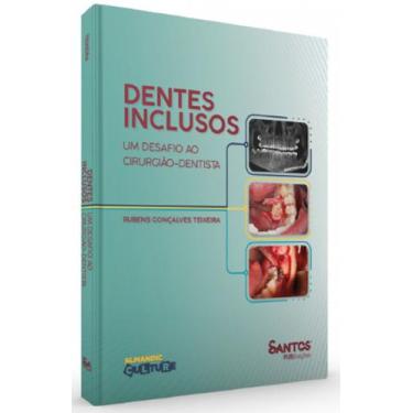 Imagem de Dentes Inclusos  Um Desafio Ao Cirurgião-Dentista - Santos Publicações