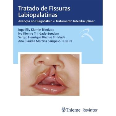 Imagem de Tratado de Fissuras Labiopalatinas: Avanços no Diagnóstico e Tratamento Interdisciplinar