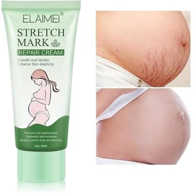 Imagem de Creme Para Estrias Remover Cicatrizes De Gravidez Creme Para Acne Tratamento Para Estrias Maternidade Reparação Antienvelhecimento Anti-rugas Creme Corporal Firmador, 3 Pcs