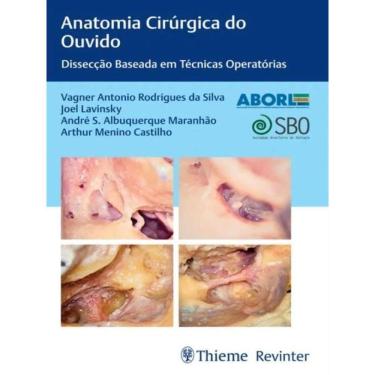 Imagem de Anatomia Cirurgica Do Ouvido