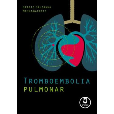 Imagem de Livro - Tromboembolia Pulmonar