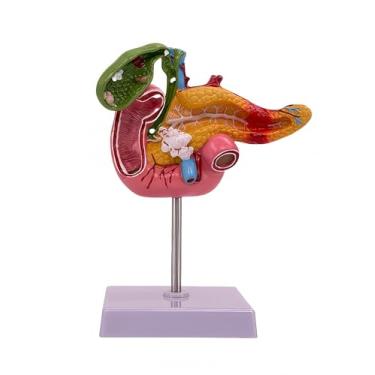 Imagem de Modelo de pâncreas hepatobiliar com cálculos biliares - Kit de treinamento de cirurgia da vesícula biliar - Auxílio de ensino de medicina para gastroenterologia e biologia do sistema digestivo