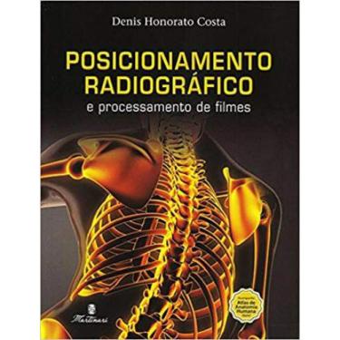 Imagem de Posicionamento radiografico e processamento de filmes - MARTINARI