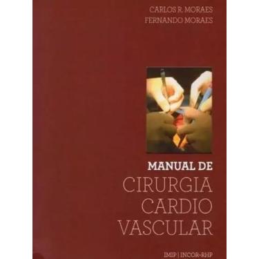 Imagem de Livro - Manual de cirurgia cardiovascular