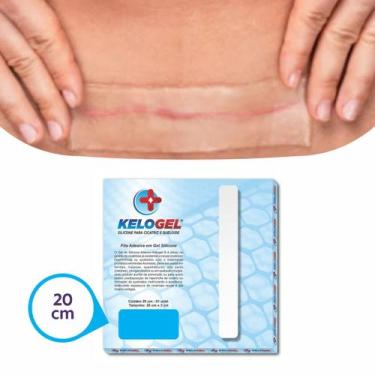 Imagem de Fita Para Cicatriz Queloide Gel Silicone Kelogel 20cm X 3cm