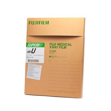 Imagem de Filme p/raio x 30 x 40 c/100 - fujifilm