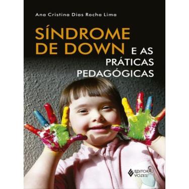 Imagem de Síndrome De Down E As Práticas Pedagógicas