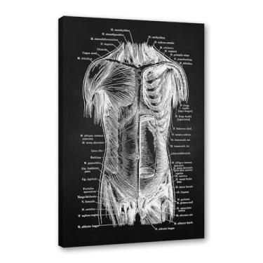 Imagem de Fundo preto anatomia humana arte médica impressões em tela imagens esqueleto músculo pôster vintage educação pintura arte decoração de parede (SKU1,40.6x50.8 cm = (40x50cm), emoldurado (tela embalada