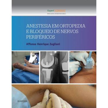 Imagem de Anestesia Em Ortopedia E Bloqueio De Nervos Perifericos