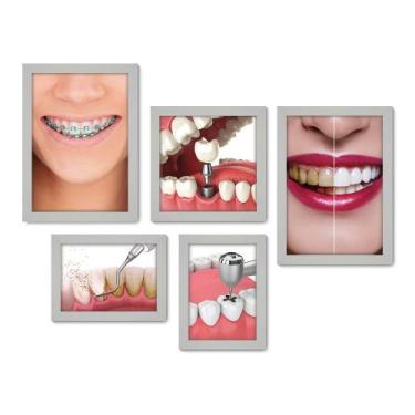 Imagem de Kit Com 5 Quadros Decorativos - Dentista Consultório - 185kq01b - Allo