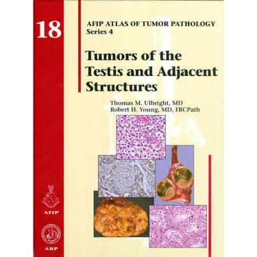 Imagem de Tumors Of The Testis And Adjacent Structures