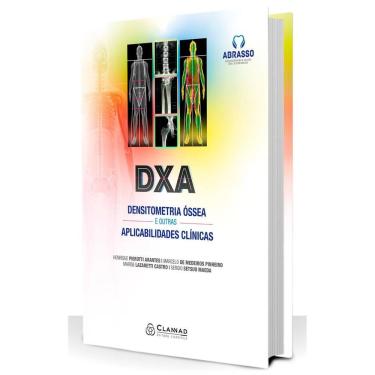 Imagem de Dxa  Densitometria Ossea E Outras Aplicabilidades Clinicas
