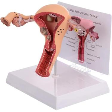 Imagem de Sistema Reprodutivo Feminino Modelo De útero Humano Modelo De Ovário De útero 3d, Sistema Reprodutivo Feminino Para Ensino De Aprendizagem