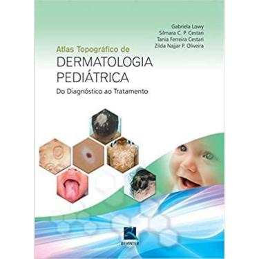 Imagem de Atlas Topografico De Dermatologia Pediatrica - Do Diagnostico Ao Tratamento
