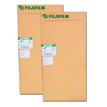 Imagem de Filme para RaioX 35x91 Colunão - fujifilm