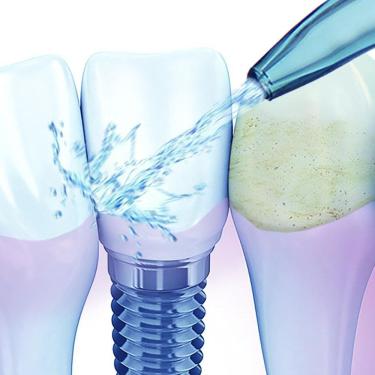 Imagem de Irrigador Dental Veitsmile Water Jet