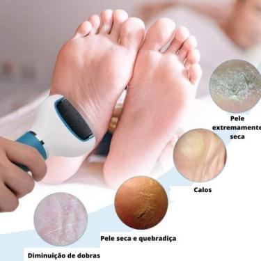 Imagem de Aparelho Esfoliador Lixar Pé Calcanhar Removedor de Calos - hOME E mOR