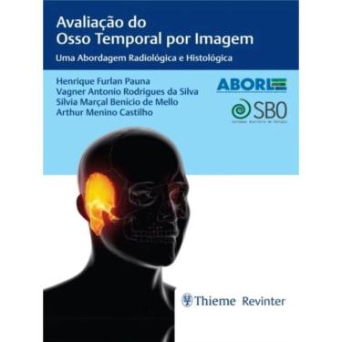 Imagem de Avaliacao Do Osso Temporal Por Imagem