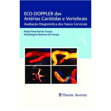 Imagem de Eco Doppler Das Arterias Carotidas E Vertebrais